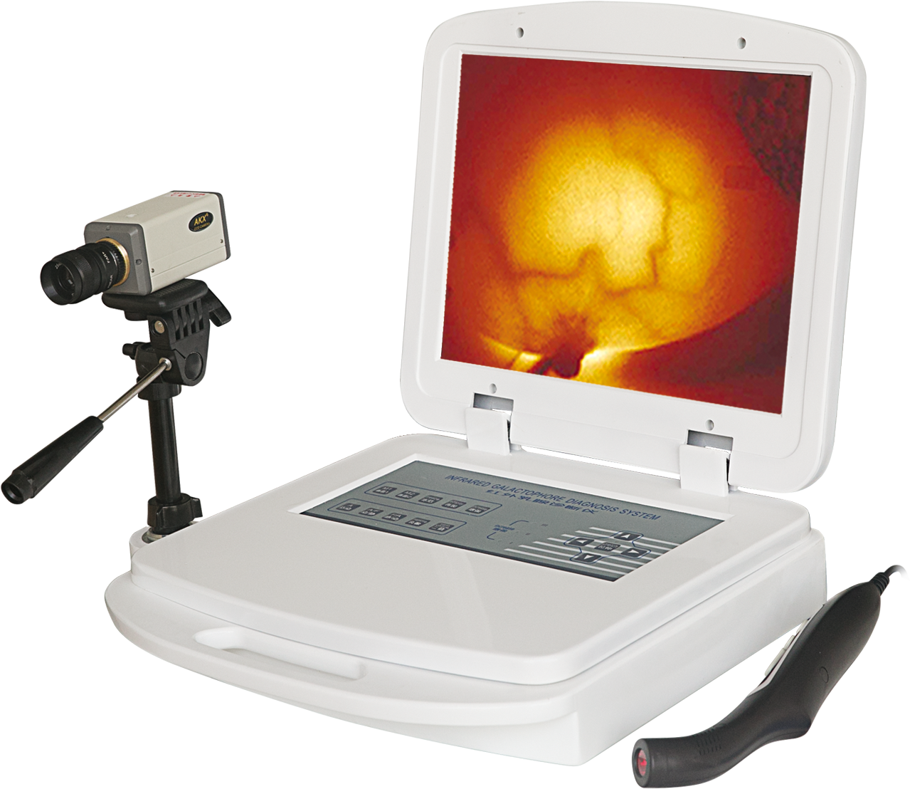 RX-1200B红外乳腺诊断仪（便携式）